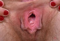 ATK hairy  in young and hairy