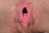 ATK hairy Nickey Huntsman Set