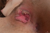 ATK hairy Nickey Huntsman Set