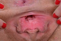 ATK hairy  in young and hairy