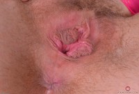 ATK hairy  in young and hairy