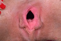 ATK hairy  in young and hairy