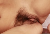 ATK hairy  in mature and hairy