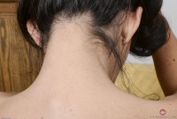 ATK hairy  in mature and hairy