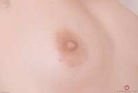 ATK hairy  in young and hairy