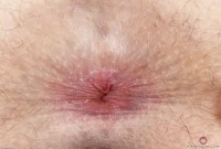 ATK hairy Niki Snow Set