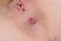 ATK hairy  in young and hairy