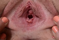 ATK hairy Niki Snow Set