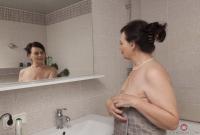 ATK hairy  in mature and hairy