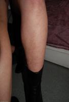 ATK hairy Nixi Set