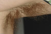 ATK hairy Nixi in hairy lesbians