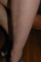 ATK hairy  in hairy lesbians