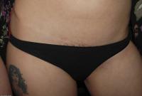 ATK hairy Nixi Set