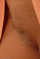 ATK hairy  in young and hairy