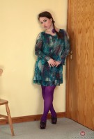 ATK hairy  in mature and hairy