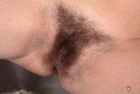 ATK hairy  in mature and hairy