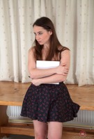 ATK hairy  in mature and hairy