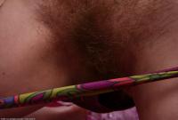 ATK hairy  in mature and hairy