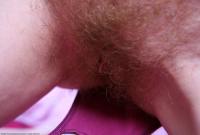 ATK hairy  in mature and hairy