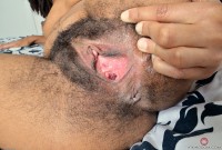 ATK hairy  in exotic and hairy