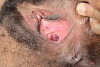 ATK hairy  in exotic and hairy