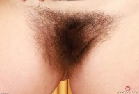 ATK hairy  in young and hairy