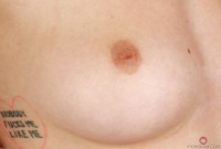 ATK hairy  in young and hairy