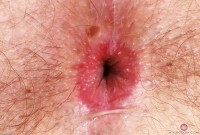 ATK hairy Olivia Marie in young and hairy