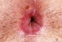 ATK hairy Olivia Marie Set