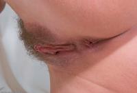 ATK hairy  in young and hairy