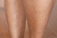 ATK hairy  in exotic and hairy