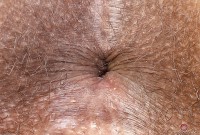 ATK hairy  in exotic and hairy