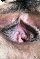 ATK hairy  in exotic and hairy