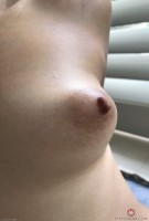 ATK hairy Iris Ivy Set