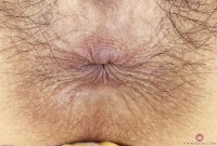 ATK hairy  in exotic and hairy