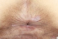 ATK hairy Iris Ivy Set