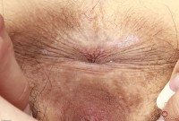 ATK hairy Iris Ivy Set