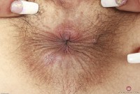 ATK hairy Iris Ivy Set