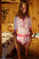ATK hairy  in mature and hairy