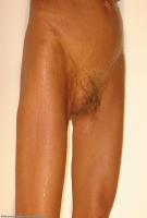 ATK hairy  in mature and hairy