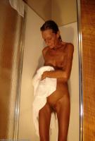 ATK hairy  in mature and hairy