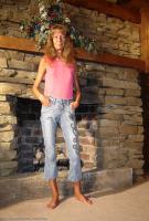 ATK hairy  in mature and hairy