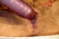 ATK hairy  in mature and hairy