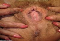 ATK hairy  in mature and hairy