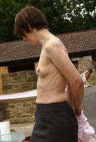 ATK hairy  in mature and hairy