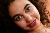 ATK hairy  in mature and hairy