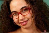 ATK hairy  in mature and hairy