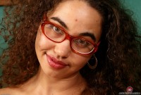ATK hairy  in mature and hairy