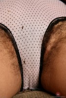 ATK hairy  in mature and hairy