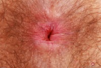 ATK hairy  in scary hairy